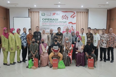 Bank Banten Berikan Operasi Bibir Sumbing Gratis Kepada Masyarakat Banten