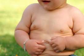 Anak Obesitas, Saat Dewasa Kemungkinan Besar Obesitas Juga