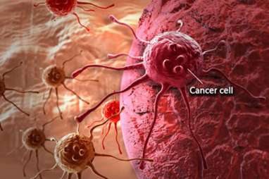 Kematian Jupe Bisa Jadi Momentum Pencegahan Kanker Serviks