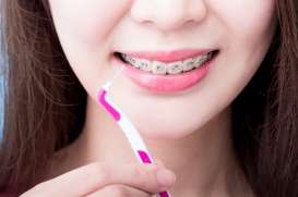 Ortodonti, Bukan Sekadar Pasang Kawat Gigi