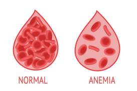 Cegah Anemia pada Ibu Hamil, Kenali Gejala dan Faktor Risikonya!