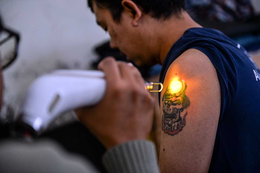 Petugas menggunakan laser khusus untuk menghapus tato seorang peserta hapus tato gratis di Masjid Al latif, Bandung, Jawa Barat, Sabtu (1/4/2023). Komunitas Hijrah Care bersama DKM Masjid Al Latif mengadakan program hapus tato secara gratis pada akhir pekan selama bulan Ramadhan. ANTARA FOTO/Raisan Al Farisi