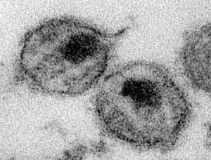  Ilmuwan temukan cara ‘lucuti’ virus AIDS