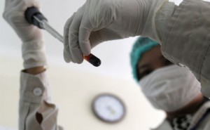  Kemenkes rilis hasil survei HIV-AIDS