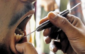  Waduh, ribuan tukang gigi protes larangan praktik oleh menkes 