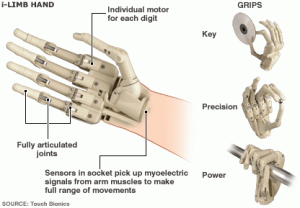  Tangan Palsu Bionik Akan Segera Ditransplantasikan