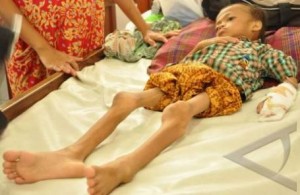  60.000 Balita di Banten Alami Gizi Buruk