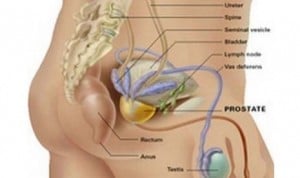  KANKER PROSTAT Jadi Momok Menakutkan bagi Kaum Pria