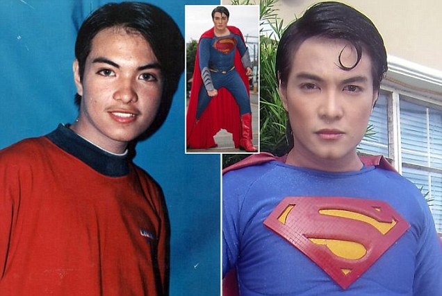  Pria Ini Operasi Wajah Habis-habisan Agar Mirip Superman
