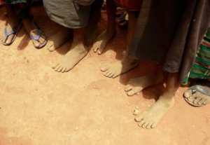  Kurangi Kemiskinan, Cimahi Luncurkan Database MDGs