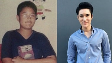  Pemuda Jelek Ini Sekarang Mirip Artis Usai Operasi Plastik