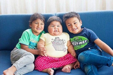  Kena Penyakit Langka, Bayi 10 Bulan Terlihat Berumur 5 Tahun