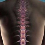  Bagaimana Mengenali dan Mencegah Osteoarthritis