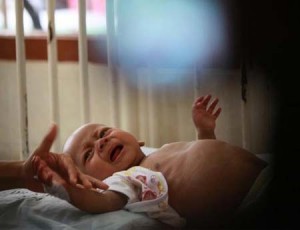  Indonesia Masuk Zona Darurat Gizi di Dunia