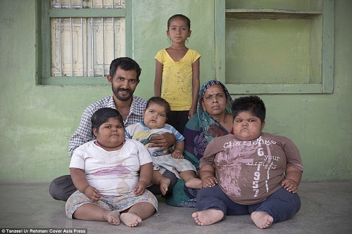  Seorang Ayah Ingin Jual Ginjal untuk Biayai Tiga Anak Obesitasnya