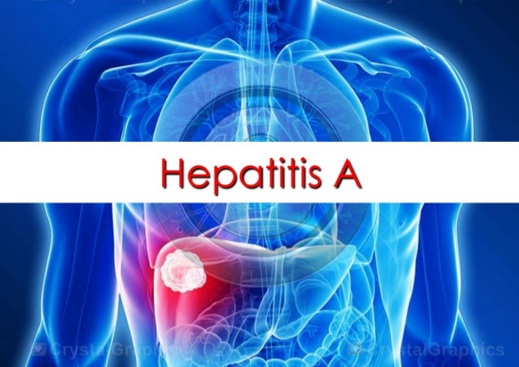  Kabupaten Bandung Waspadai Hepatitis A