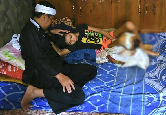  Kisah Bupati Dedi Bujuk Anak Penderita Tumor Yang Tolak ke Rumah Sakit
