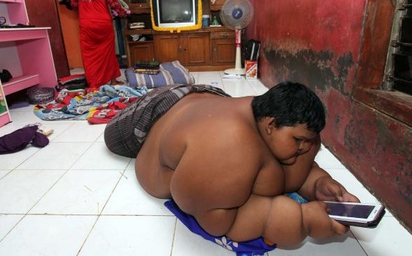  ARYA OBESITAS: Hal Yang Perlu Diwaspadai Jika Anak Anda Gemuk