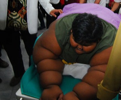  Posyandu Diminta Pantau Kasus Obesitas Seperti Arya