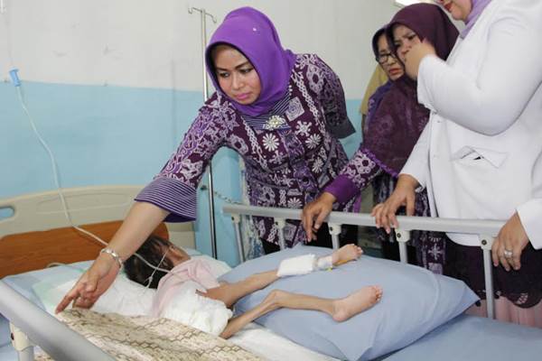  Kasus Gizi Buruk Sumut, Istri Gubernur Sampai Teteskan Air Mata Lihat Azizah