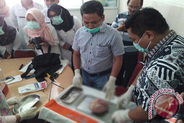  Perempuan di Jambi Lahirkan Bayi Membatu 37 Tahun