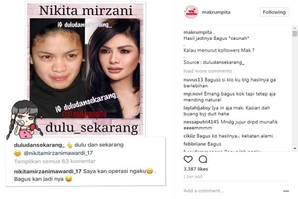  Nikita Mirzani Dipuji Karena Mengaku Operasi Plastik