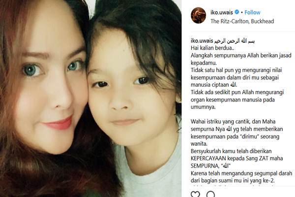  Penyanyi Audy Hamil Anak Kedua, Ini Doa Iko Uwais Sang Suami