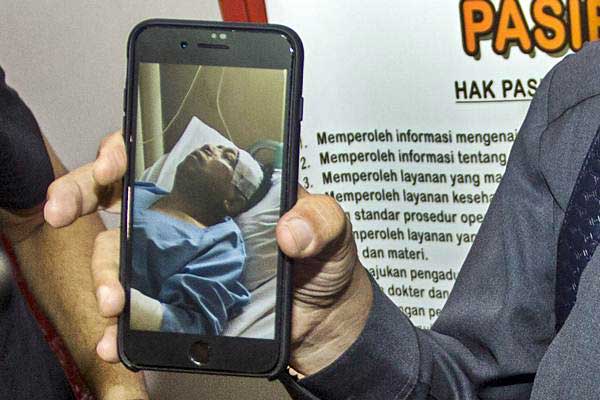  Setya Novanto Kecelakaan, Jusuf Kalla: Biasanya Juga Cepat Sembuh