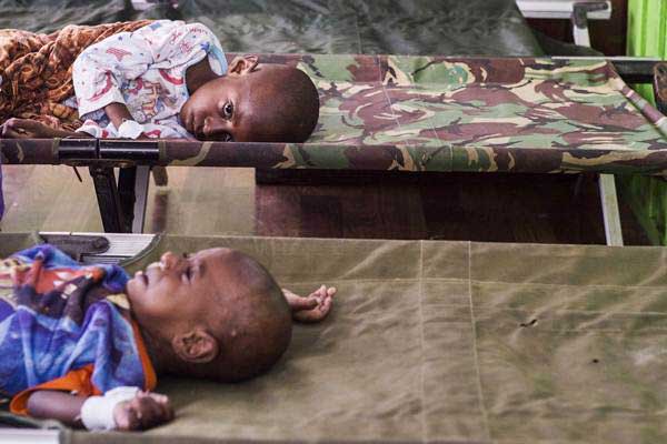  34 Kasus Gizi Buruk di Jakarta Utara