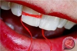  40% Generasi Muda Alami Ngilu Gigi Sensitif