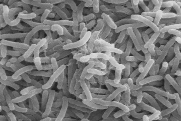 Mycobacterium leprae, bakteri penyebab kusta/Istimewa