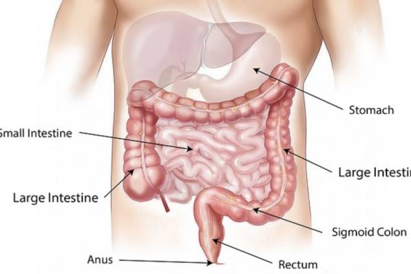  KESEHATAN DIGESTIF : Asa Baru Penderita Kanker Kolon