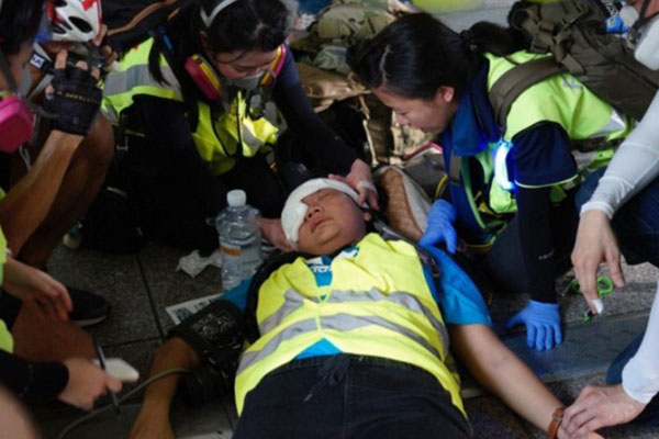  Jurnalis Indonesia Tertembak Peluru Karet di Hong Kong Dalam Kondisi Stabil