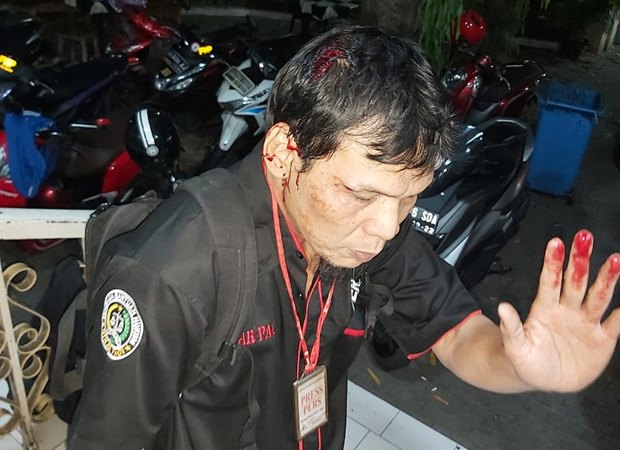  Wartawan Dipukul Hingga Berdarah Saat Rekam Keributan di Polda Metro Jaya