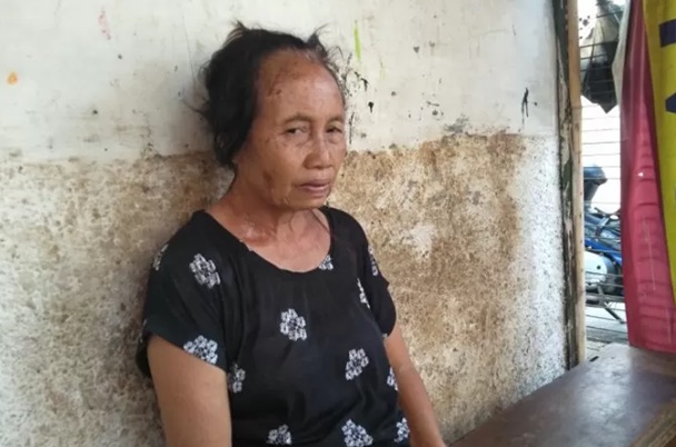  Teror Penyiraman Air Keras di Jakbar: Penjual Sayur ini Berharap Pelaku Ditangkap