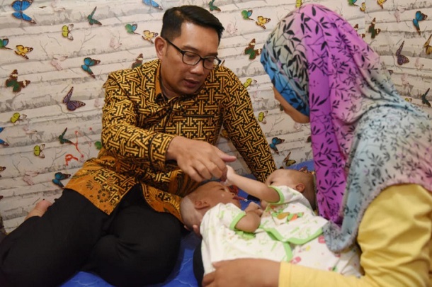  Cerita Ridwan Kamil Temui Bayi Kembar Siam di Bekasi