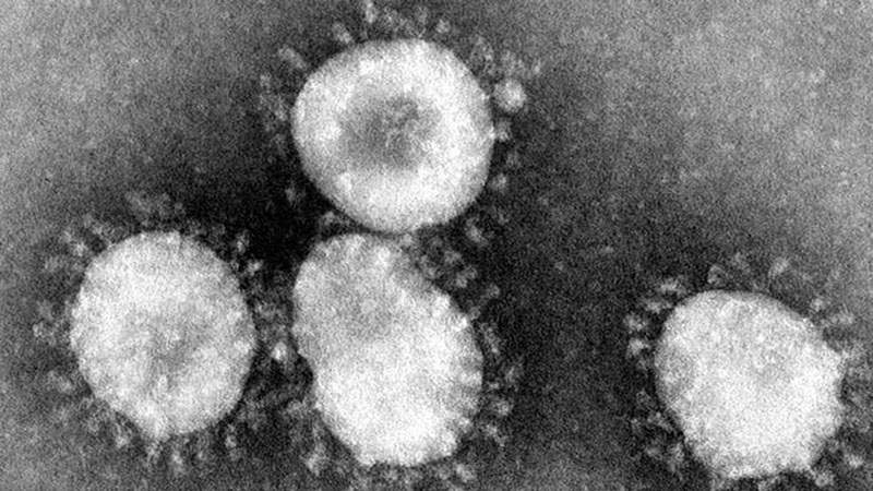  Amerika Perketat Pengawasan Cegah Coronavirus dari China