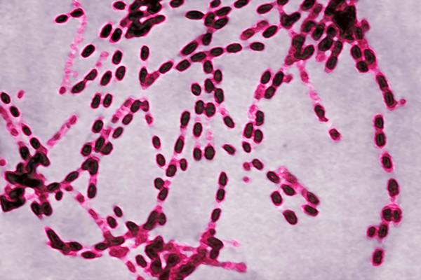 Bakteri Bacillus anthracis penyebab antraks/wikipedia