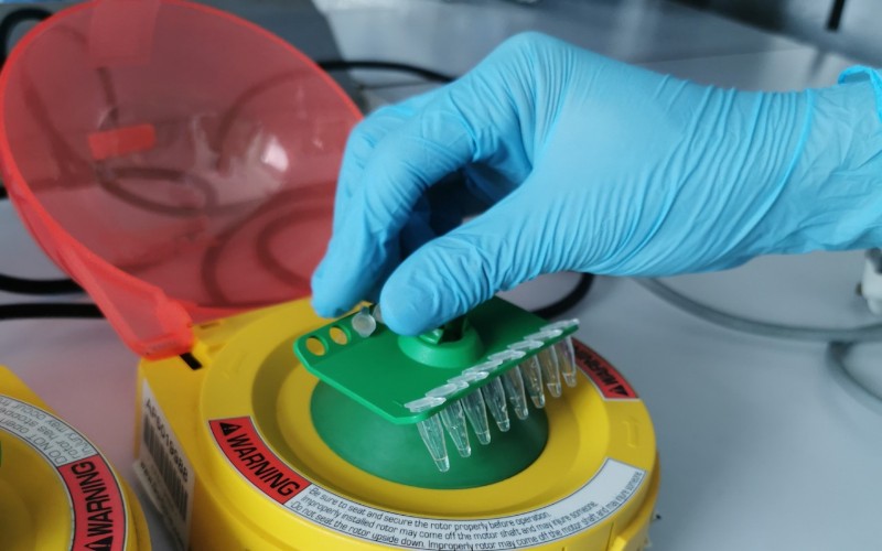  Indonesia Uji Coba Produksi Alat Tes PCR Virus Corona Transmisi Lokal