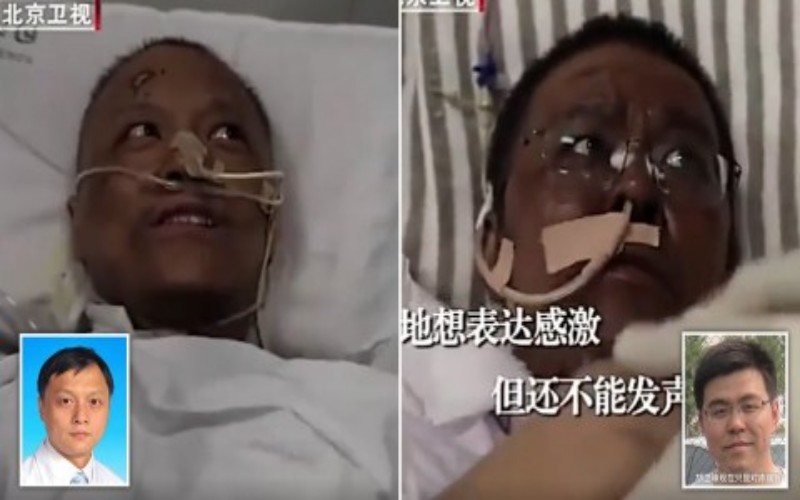  Kejadian Aneh, 2 Dokter China Terinfeksi Covid-19 Kulitnya Menghitam