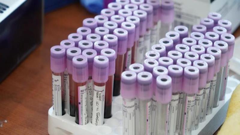  Warga Inggris Ikut dalam Uji Coba Vaksin Virus Corona, Bakal Dibayar Hingga 625 Euro