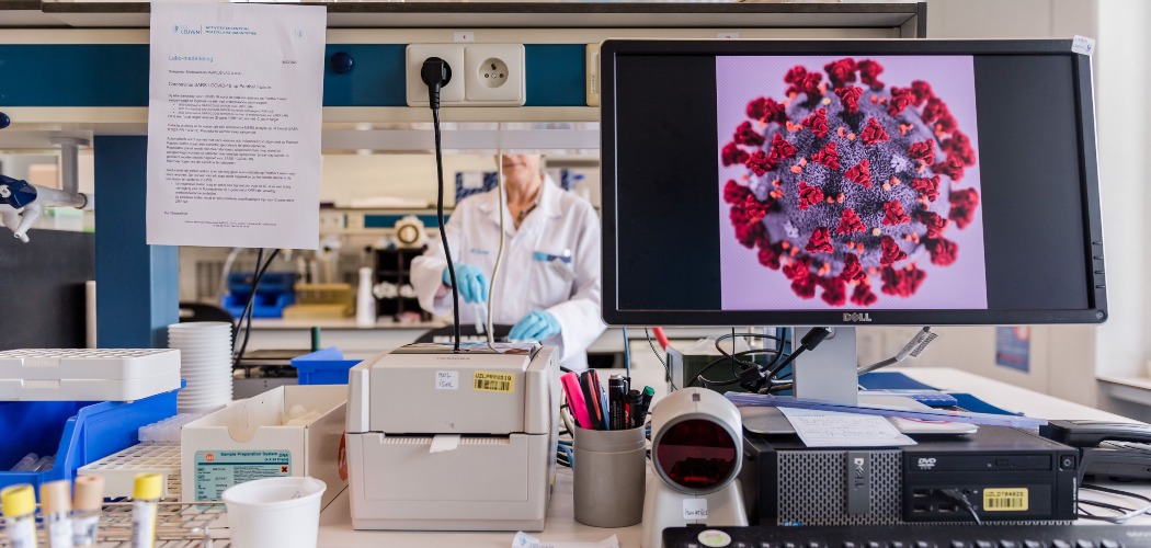 Tampilan virus corona yang diperbesar terlihat di monitor sebuah komputer di laboratorium penelitian virus di Rumah Sakit Universitas UZ Leuven, Leuven, Belgia, Jumat (28/2/2020)./Bloomberg-Geert Vanden Wijngaert