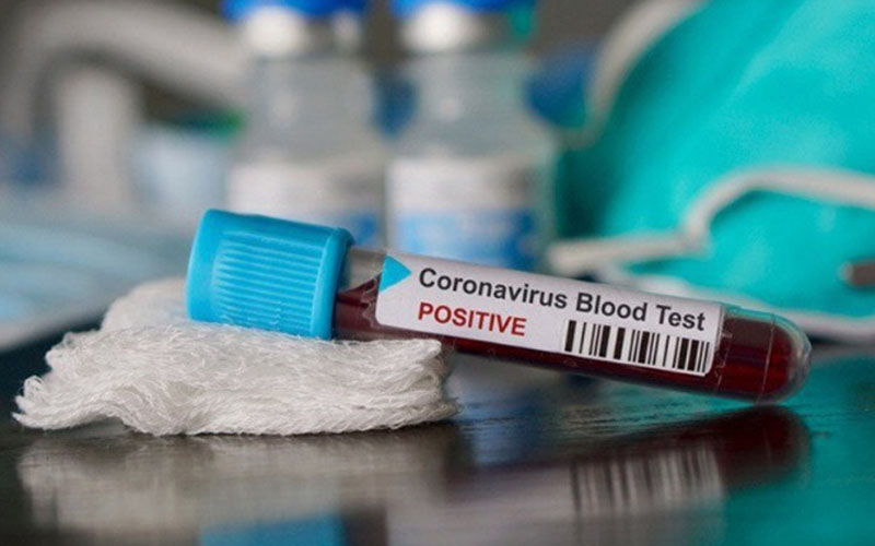 Ilustrasi-Sampel darah yang terindikasi positif virus Corona/Antara-Shutterstock