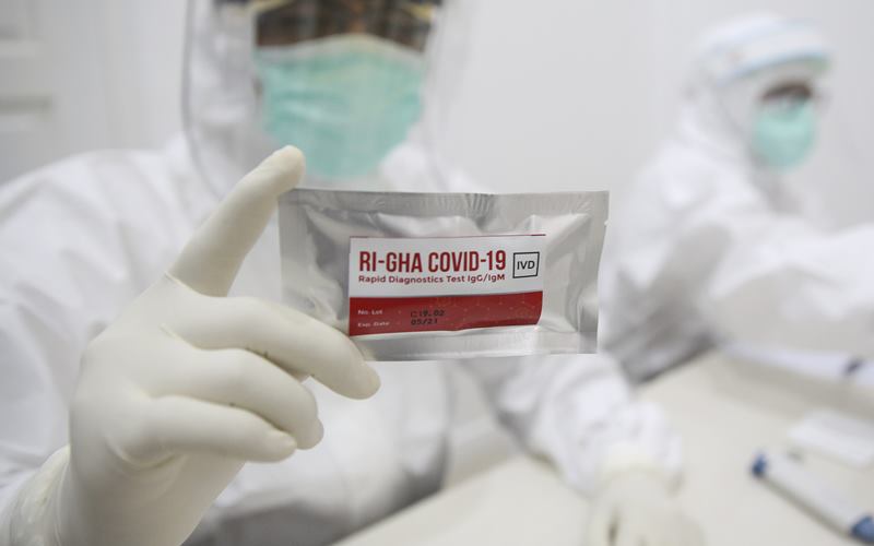  Tarif Rapid Test Corona di Sumsel Rp700.000, Ketentuan Menkes Belum Berlaku