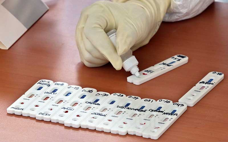 Petugas medis memperlihatkan sampel darah pengemudi angkutan umum saat tes cepat (Rapid Test) COVID-19 di Kantor Pusat Kementerian Perhubungan, Jakarta, Senin (20/4/2020). Bisnis/Eusebio Chrysnamurti