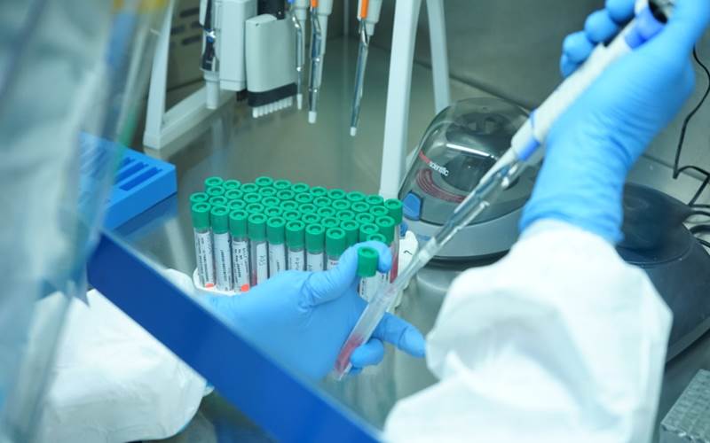  Swab PCR Berteknologi Jerman Ini Ditawarkan Mulai dari Rp800ribuan