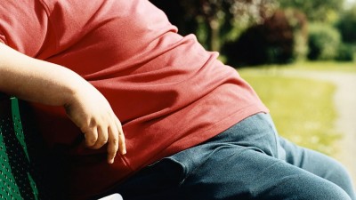  Ini Alasan Obesitas Ganggu Kesuburan