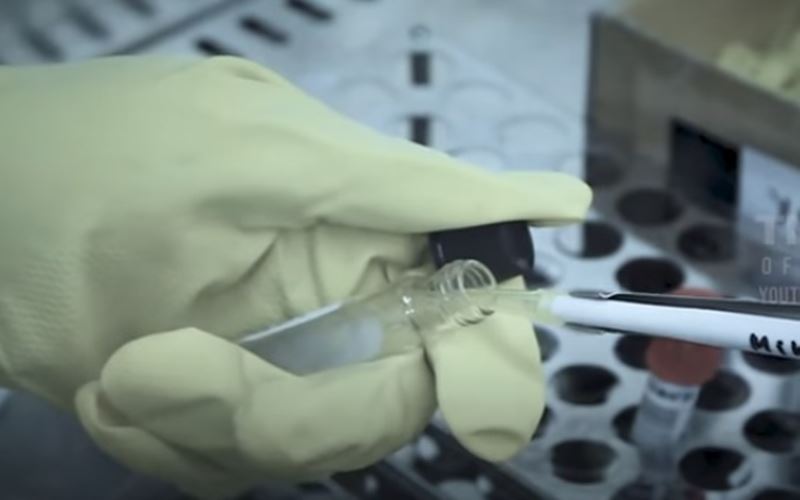  Kebutuhan Plasma Indonesia Tinggi, Minimal 10 Persen dari Total Penyintas Covid-19