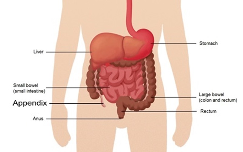  Ini Kemungkinan Pemicu Penyakit Crohn