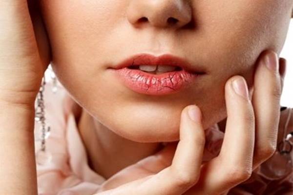 Bibir kering dan pecah menjadi gejala penyakit virus corona baru./Istimewa